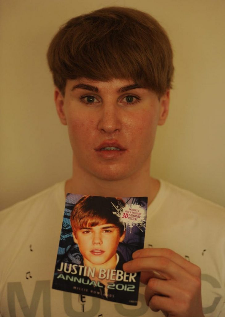 Justin Bieber Plastic Surgery? Man Spends $100,000 to Look Like the Biebs 3 Justin Bieber Surgery