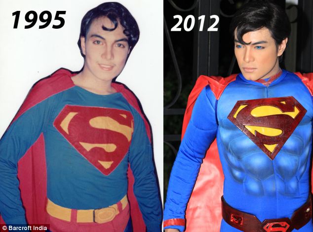 Blonde Blue-Eyed Man Had 10 Surgeries To Look Asian 1 Pinoy Herbert Chavez from Laguna who underwent 19 surgeries over 16 years to look like Clark Kent