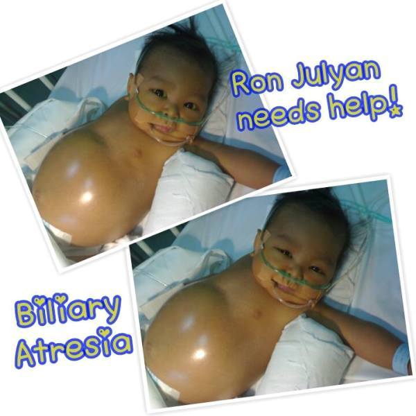 Save Baby Arianne from BA (1)