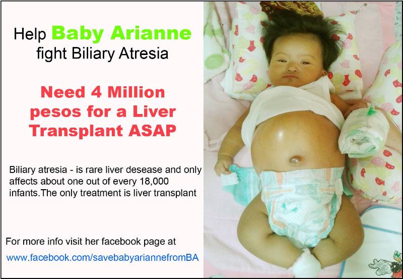Call for Help: Save Baby Arianne from Biliary Atresia 3 Save Baby Arianne from BA (2)