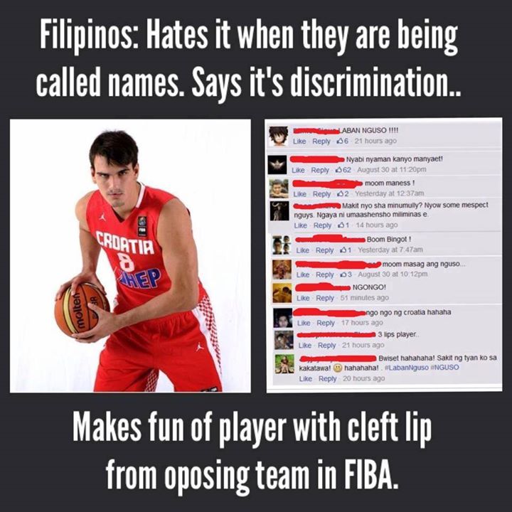Dario Saric Cleft Lip