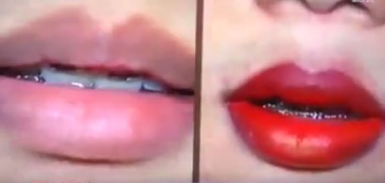 WATCH Aesthetic Center Previews Permanent Lipstick Procedure... on a Male Model