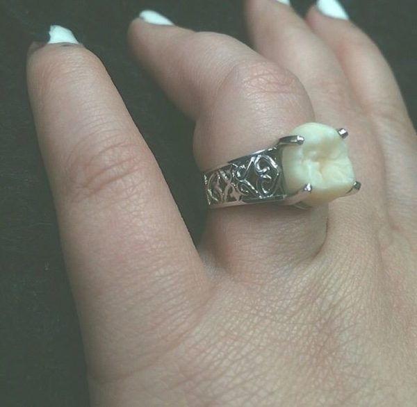 engagement ring wisdom tooth 2