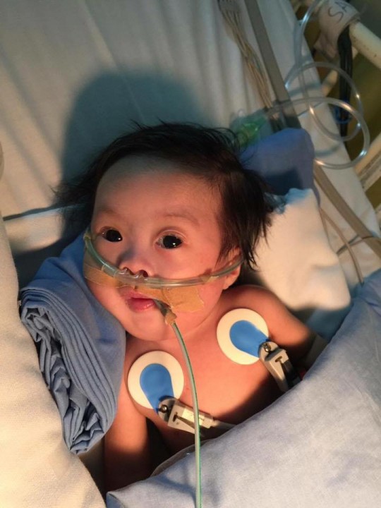 Call for Help for Baby Jerico Immanuel's Medical Needs