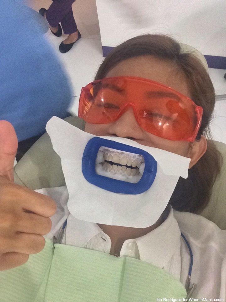 THE DENTIST IS IN: Check Up, Cleaning, Zoom Teeth Whitening at Fashion Smile Dental Clinic 3 fashionsmile-photo_2016-07-28_16-45-36
