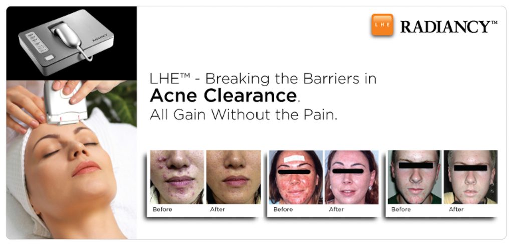 Two Non-Invasive Skin Treatments that Leave Your Skin Glowing 8 LHE-LED-Therapy-When-In-Manila-Skin-Treatment-Derma--4