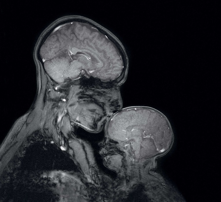 MRI Image of mother and child