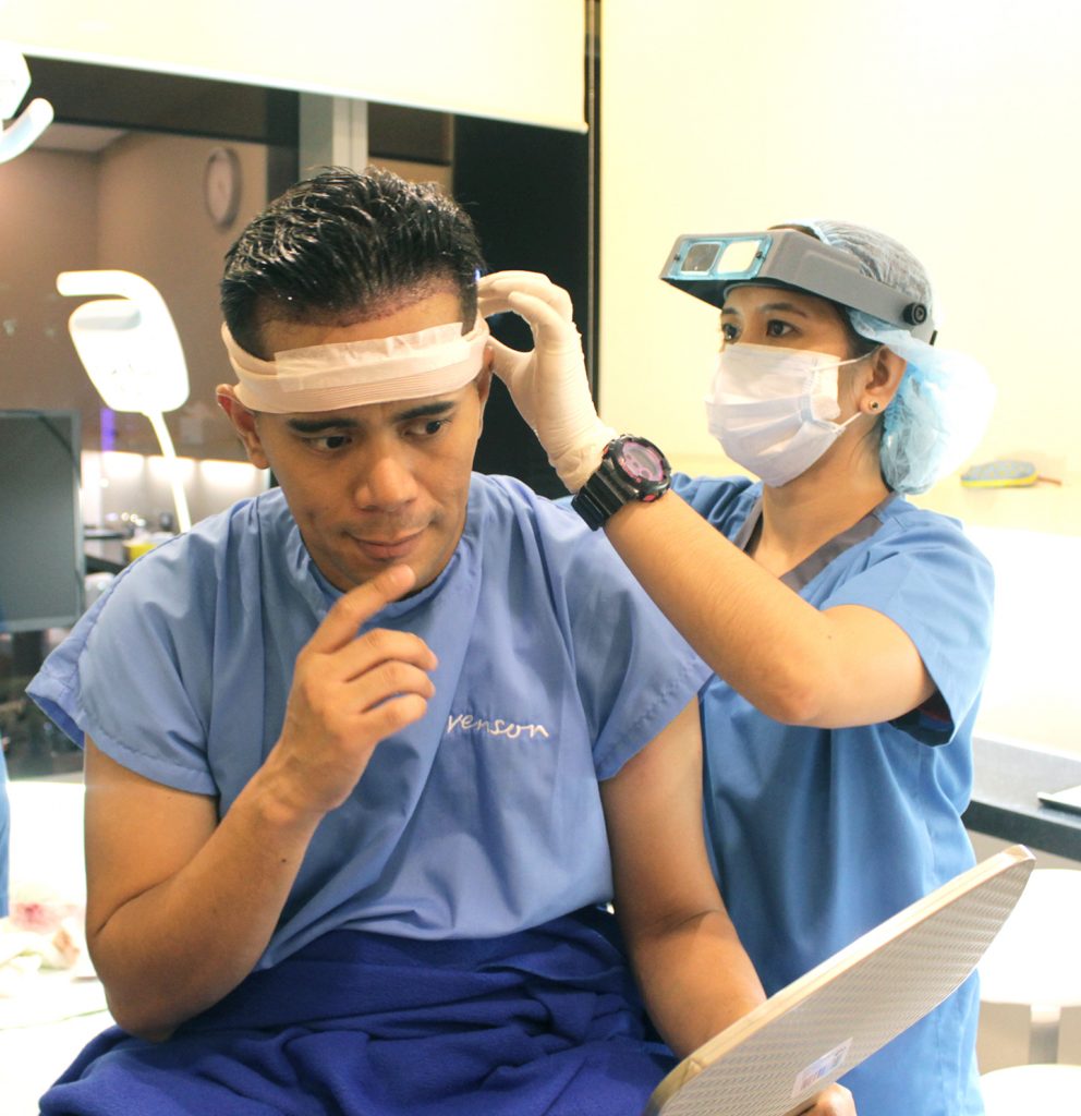 Tonipet Gaba on Svenson Hair Transplant: I finally put an end to my hair loss worries!