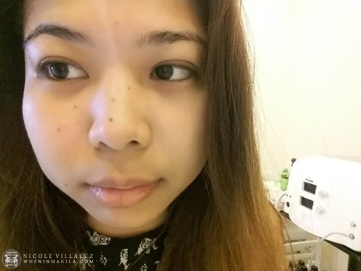My Facial Skin was Extremely Dry and Damaged. Here's What Brought it Back to Life 8 One Skin Clinic SkinPeel Facial