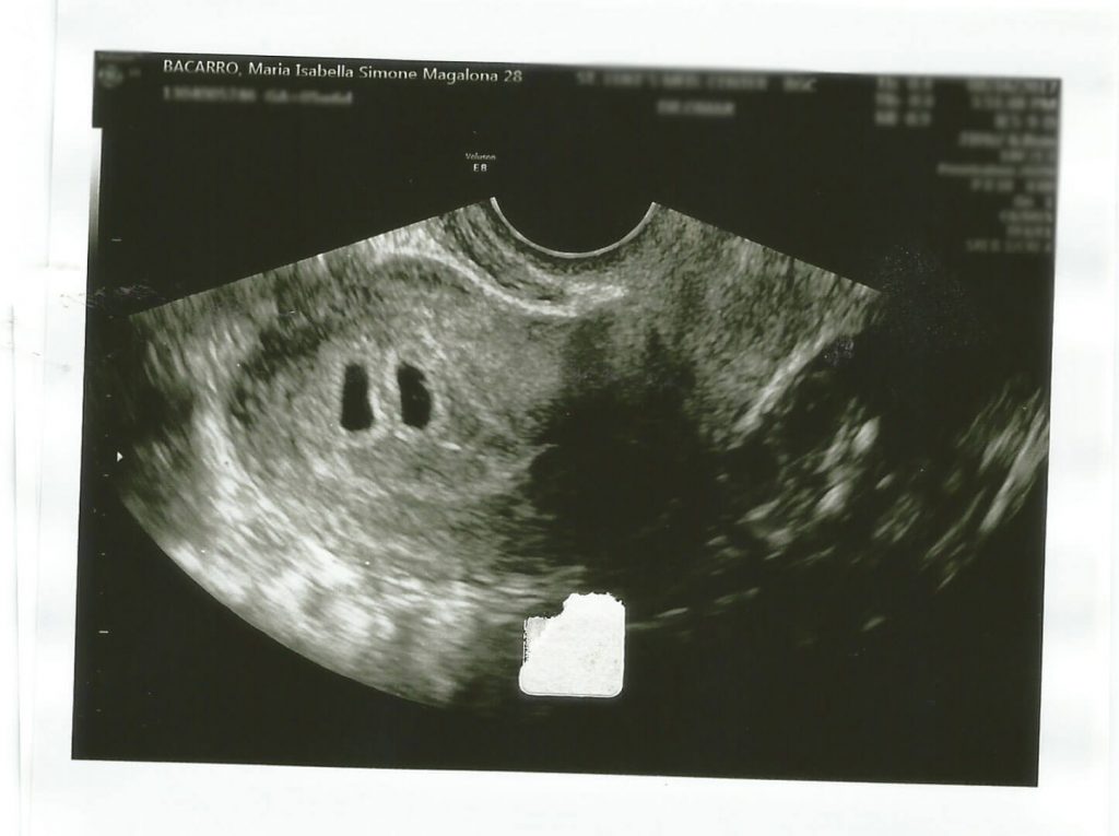 saab magalona pregnant