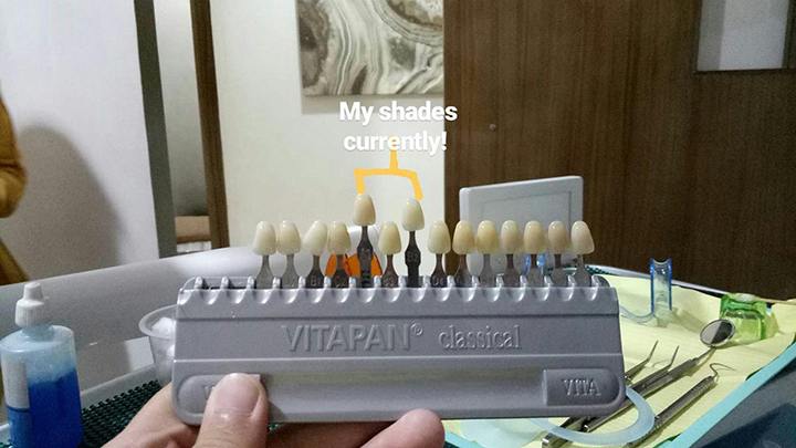 IMG 20180113 201409 112