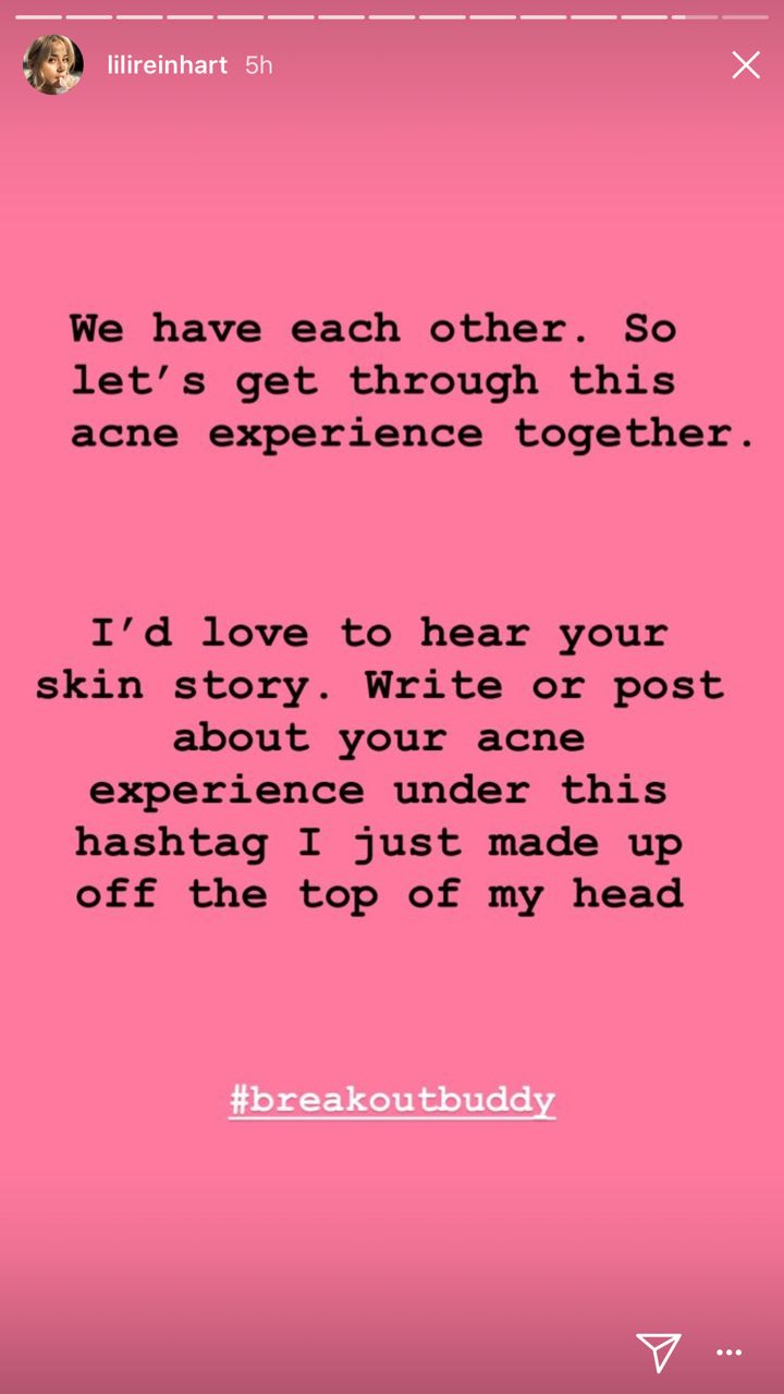 INSPIRING: 'Riverdale' actress Lili Reinhart speaks up on cystic acne insecurities 12 2018 05 23 15.12.27