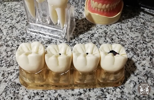 dental world teeth