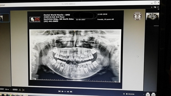 dental world xray comp