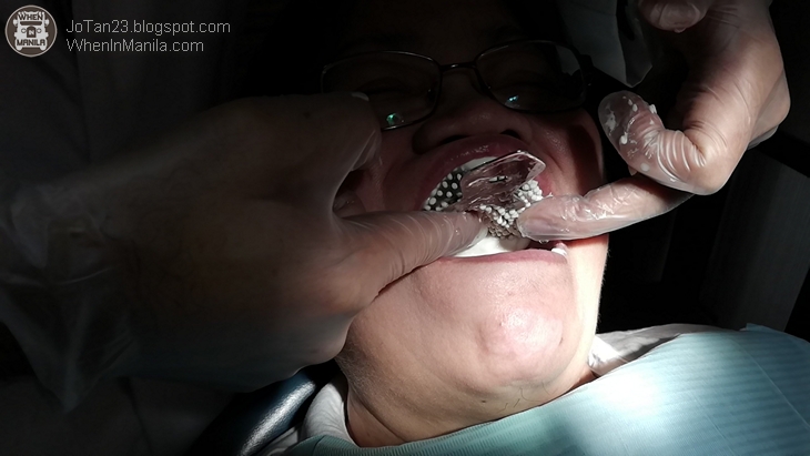 1 dental world manila dentures b