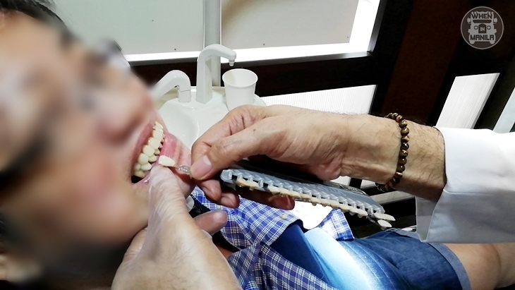 1 dental world manila dentures g