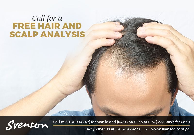 Men, Here's Why You Shouldn't Be Scared of Balding - When In Manila Men, Here's Why You Shouldn't Be Scared of Balding - When In Manila