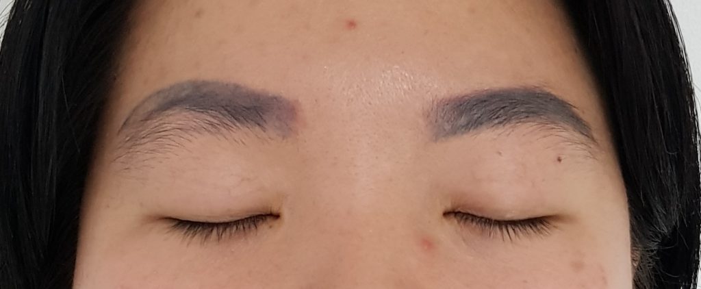 Laser Tattoo Removal: How It Works and Why You Might Want to Get It - When In Manila Laser Tattoo Removal: How It Works and Why You Might Want to Get It - When In Manila