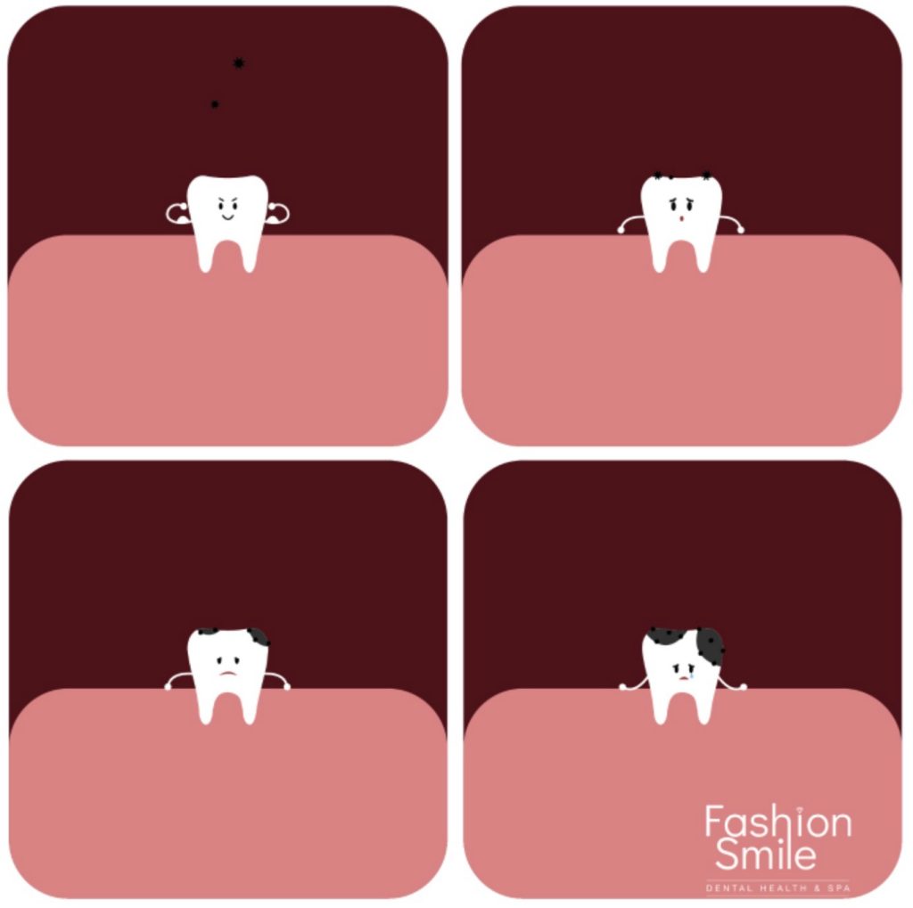 Fashion Smile Tooth Decay