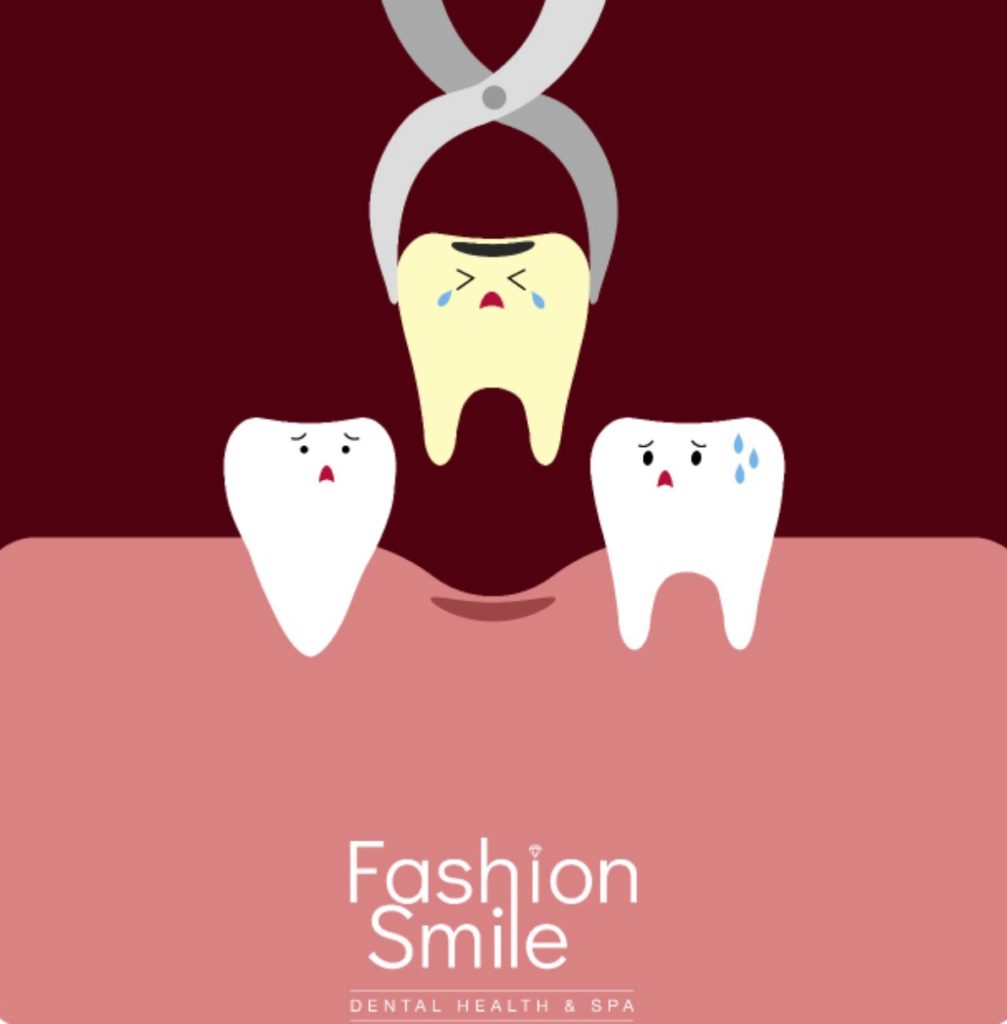 Fashion Smile Tooth Extraction