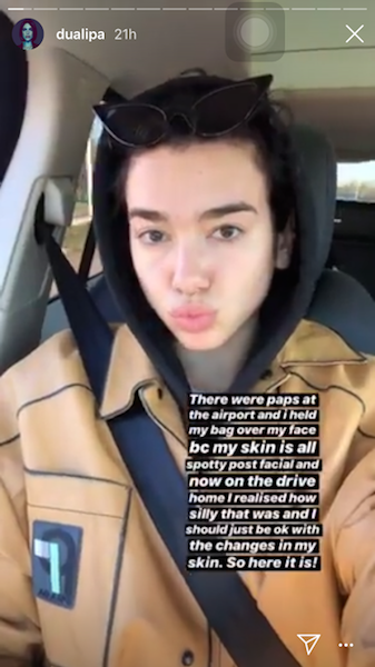 Dua Lipa posted a make-up free selfie and reminds us not to be embarrassed of 'spotty' skin 2 Dua Lipa 1
