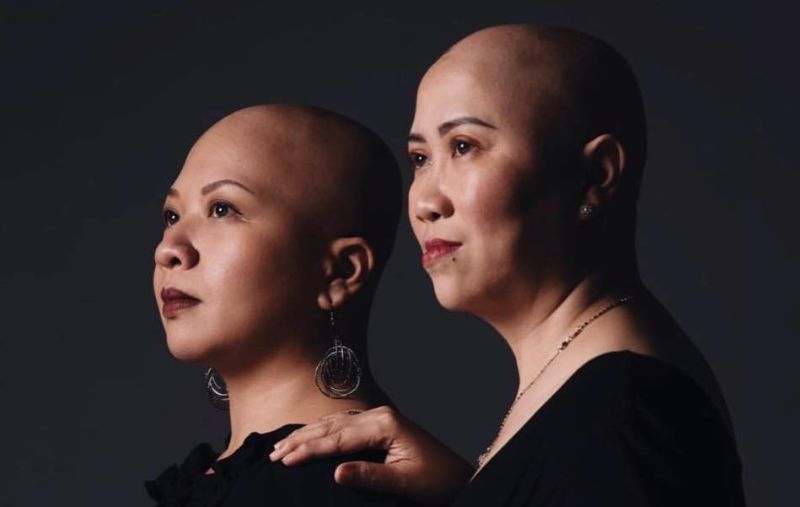 Alopecia Philippines cover 1