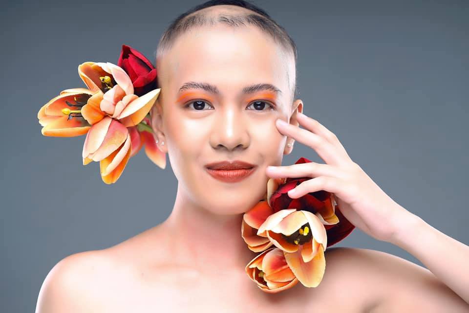 Alopecia Philippines 2