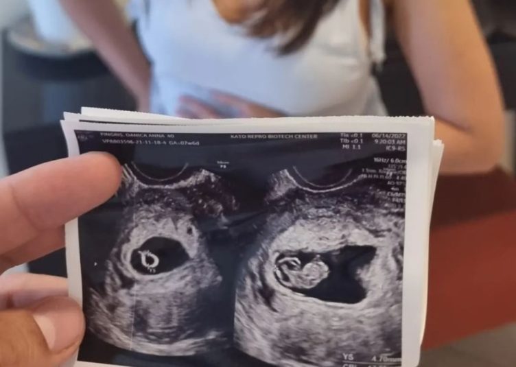 LOOK: Marc Pingris Announced Baby No. 3 With Danica Sotto!