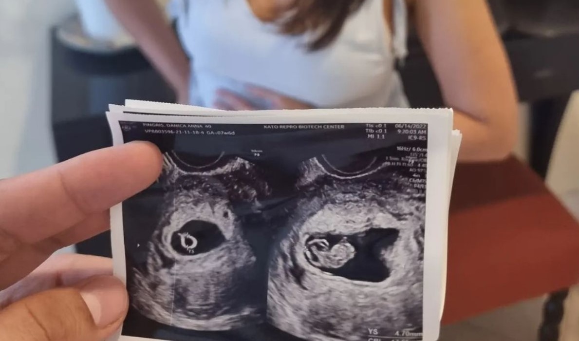 LOOK: Marc Pingris Announced Baby No. 3 With Danica Sotto!