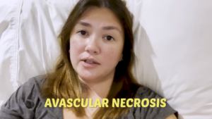 Angelica Panganiban avascular necrosis