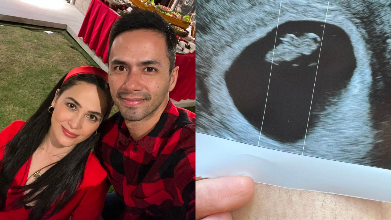 Kristine Hermosa-Sotto Pregnant With Baby Number 6