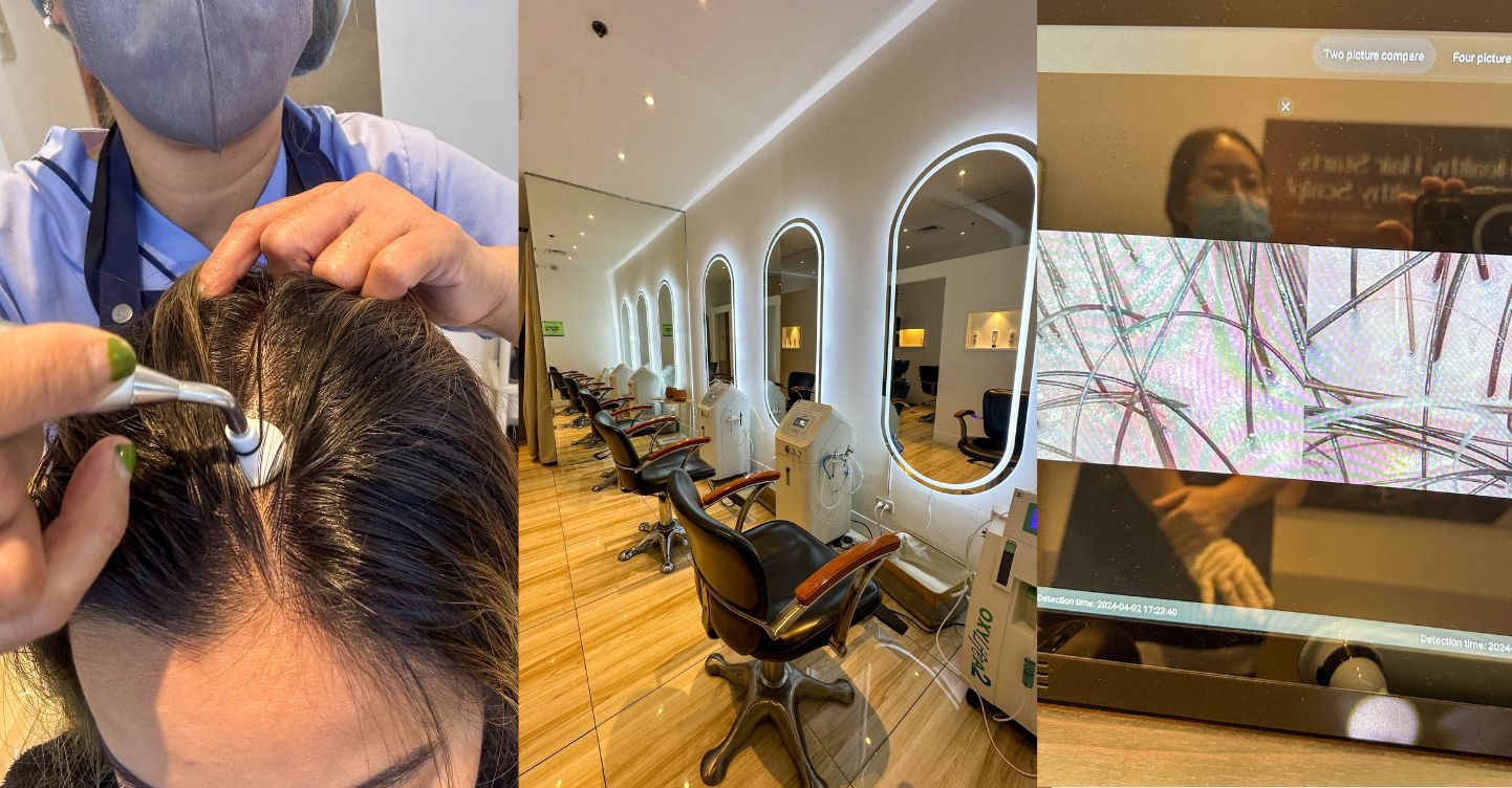 Meinas This Professional Scalp Treatment Center Will Give Your Scalp