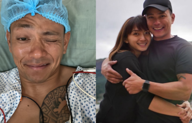 Drew Arellano vasectomy