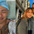 Drew Arellano vasectomy