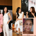 Belo Medical Group | The Scar Project | Vicky Belo, Hayden Kho