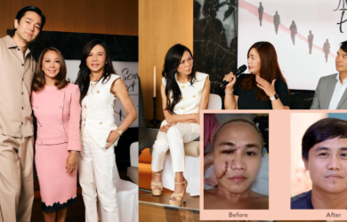 Belo Medical Group | The Scar Project | Vicky Belo, Hayden Kho